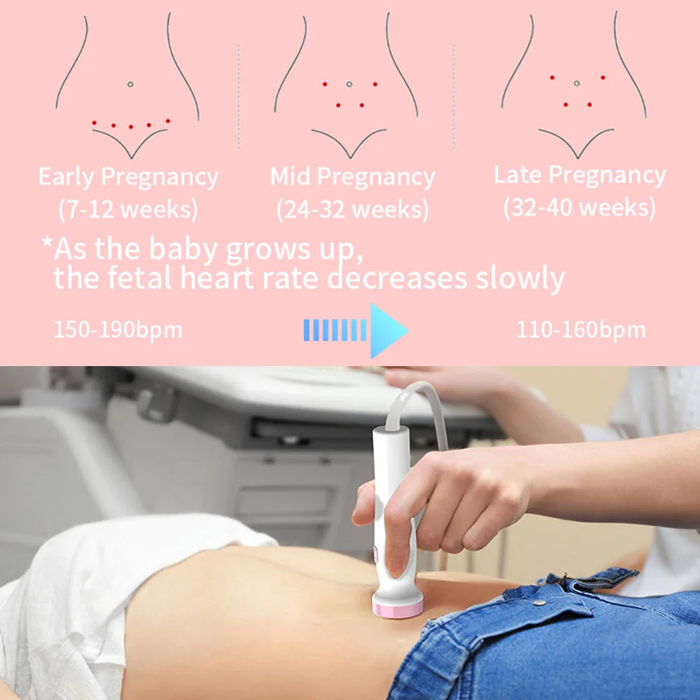 Pregnant Ultrasound Baby Heart Rate Detector